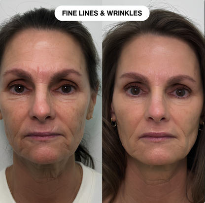 AunaBeauty™ Line Filler Primer